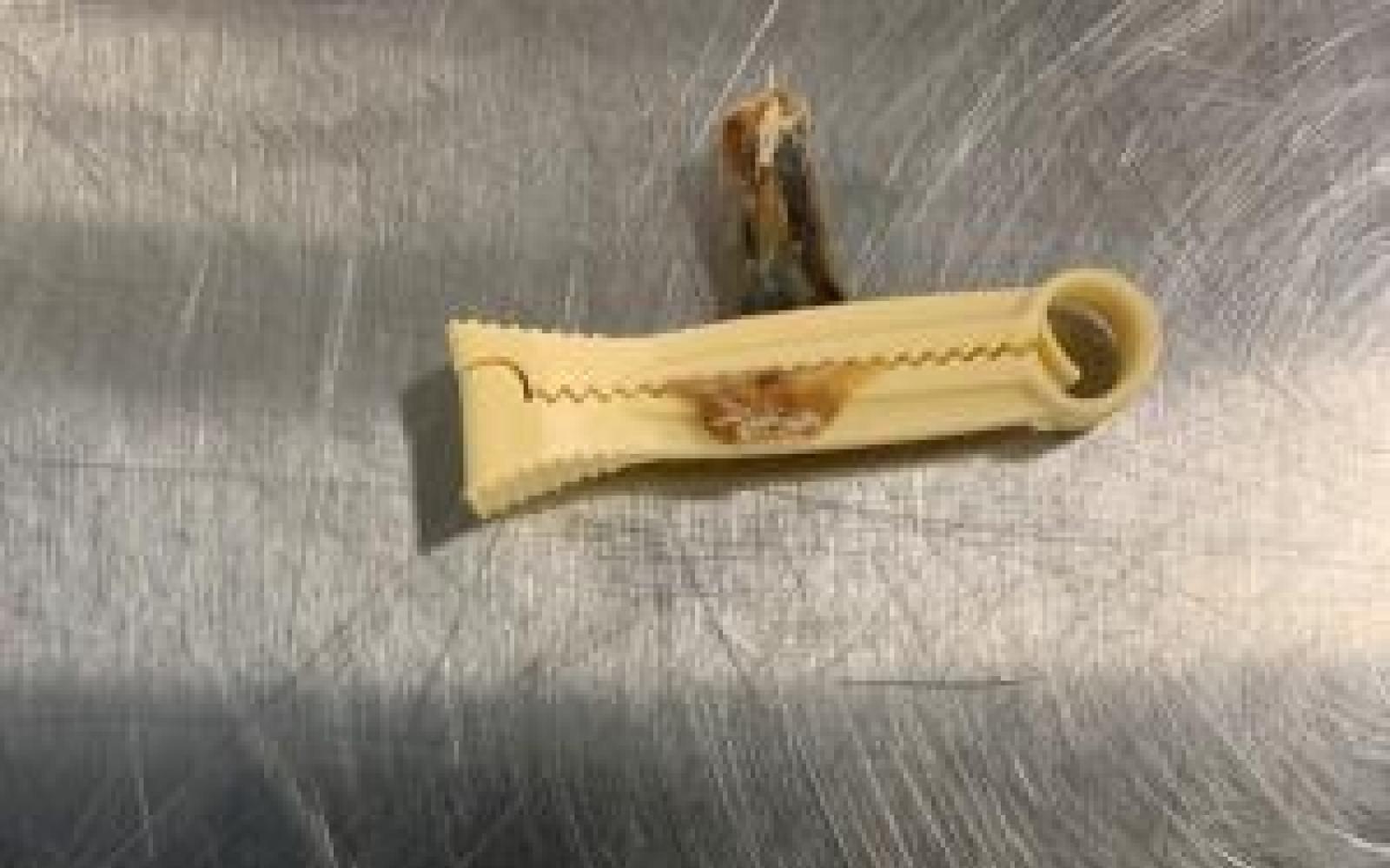 Umbilical Cord & Positive Pregnancy Test Found in Luggage (Contributed/CBP)