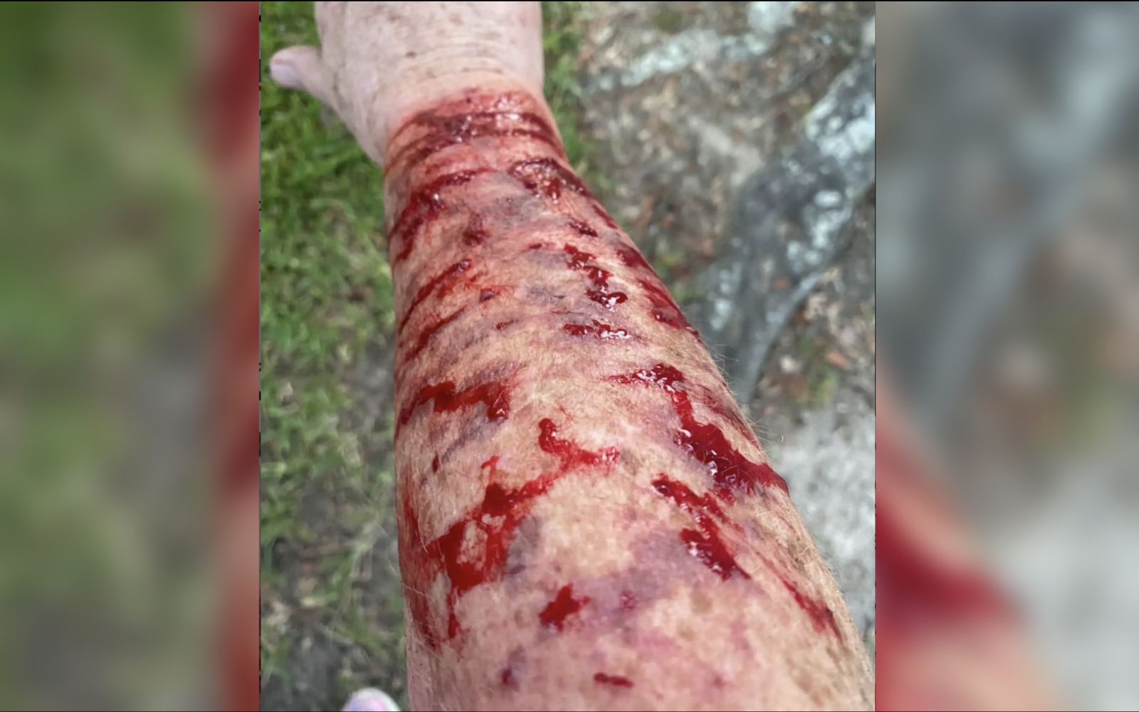 Ms. Jones injured arm after the attack.